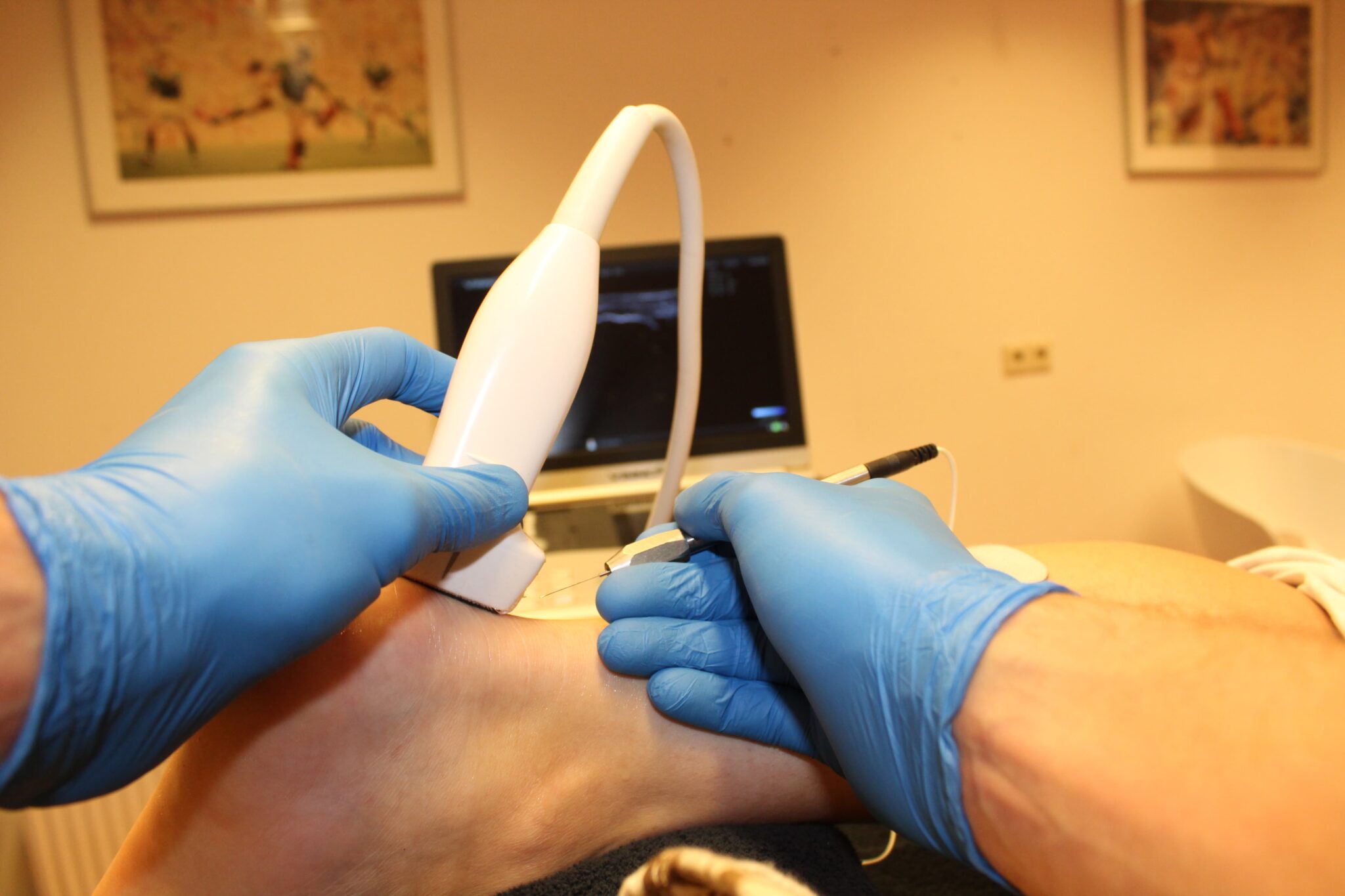 EPTE Therapie RICHARD SMITH FYSIOTHERAPIE